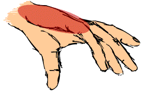 地面に触れる手の部分の図